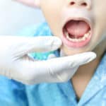 tongue tied boy - Buckeye Pediatric Dentistry in Reynoldsburg