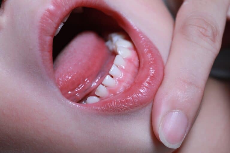 Infant oral health dentist Reynoldsburg