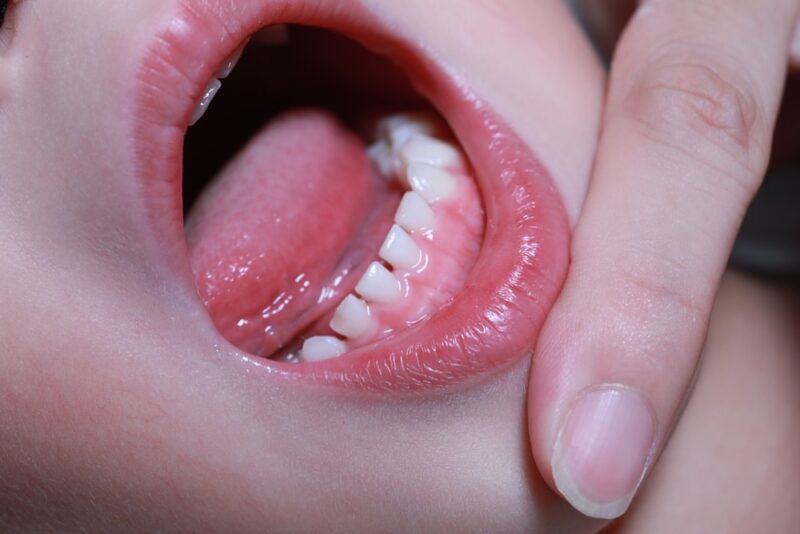 Infant oral health dentist Reynoldsburg