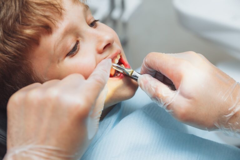 Gentle dental extractions for kids Reynoldsburg